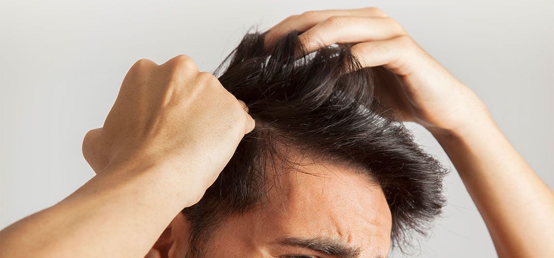 Unshaven Hair Transplantation – Unshaven FUE